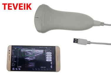 CE USB Ultrasound Machine Laptop Tablet Ultrasound Scanner Wypukła sonda