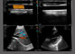 Bezprzewodowa sonda ultradźwiękowa z podwójnymi głowami 3-w-1 wypukły liniowy kolorowy doppler serca