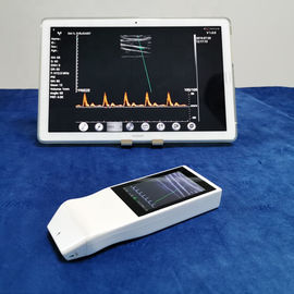 Bezprzewodowy ultradźwiękowy tranducer Android Color Doppler Sonda ultradźwiękowa Bezprzewodowe ładowanie